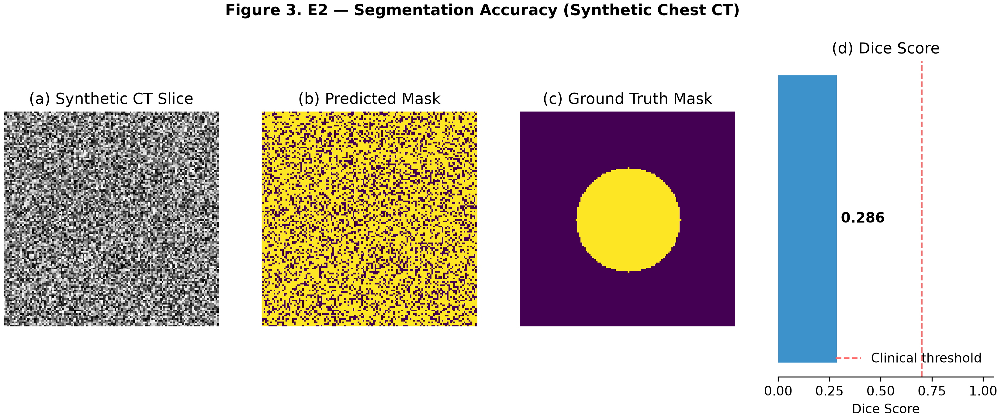 E2 Segmentation Accuracy and Boundary Precision Figure